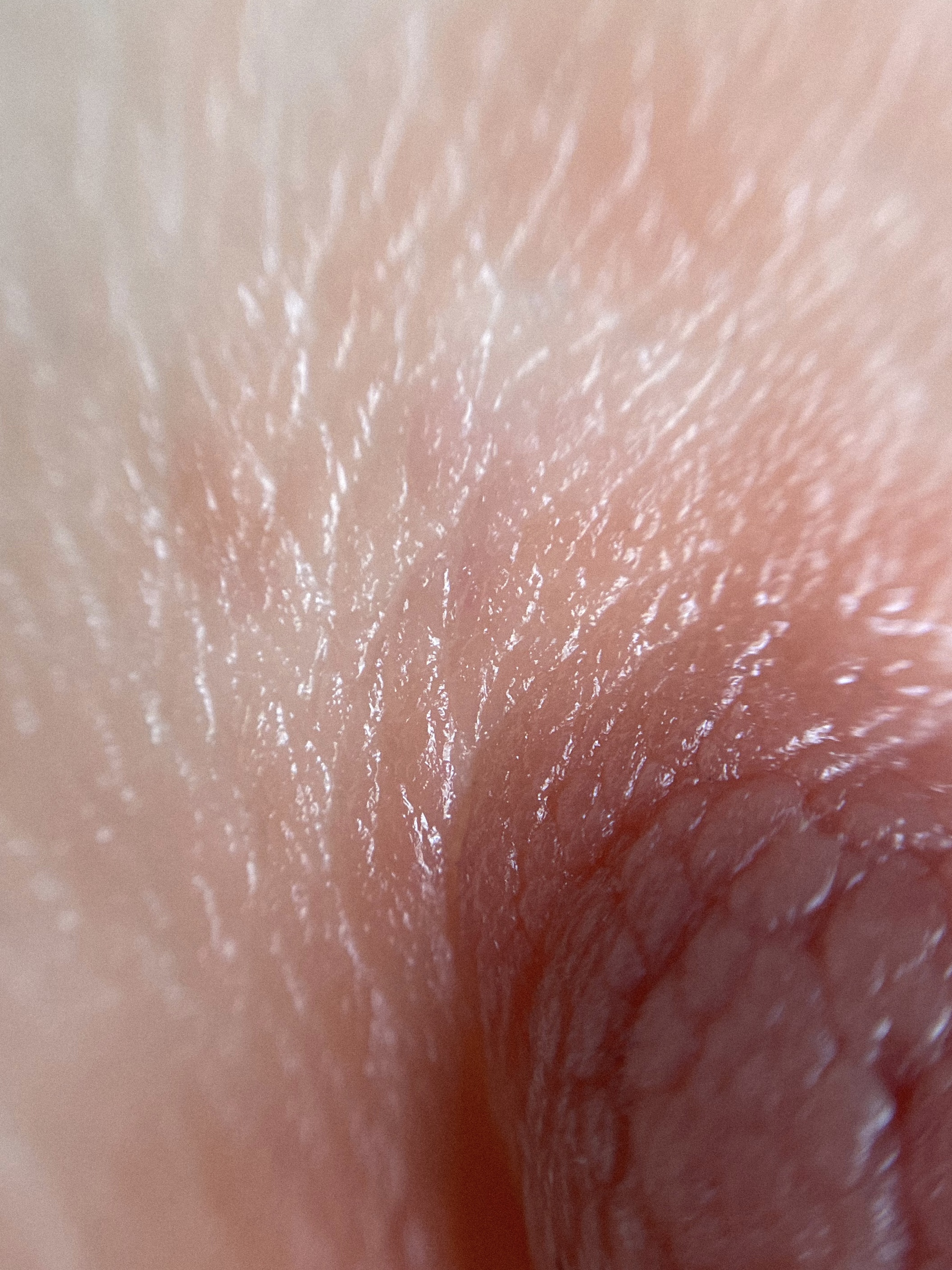 Dettaglio 3